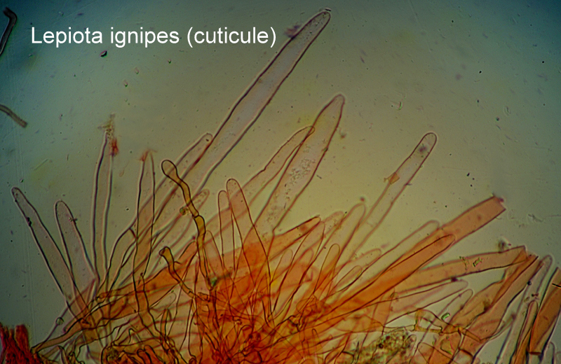 Lepiota ignipes-amf2183-cuticule.jpg